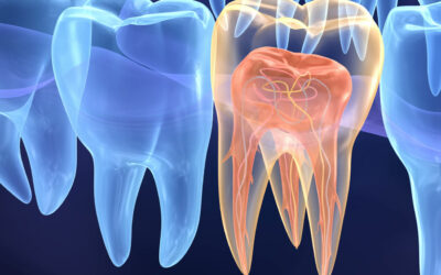 ENDODONTIA