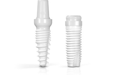 IMPLANTES DENTÁRIOS