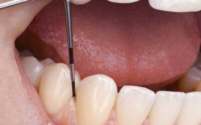 PERIODONTOLOGIA