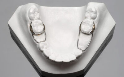 O que são os mantenedores de espaço utilizados na odontopediatria?